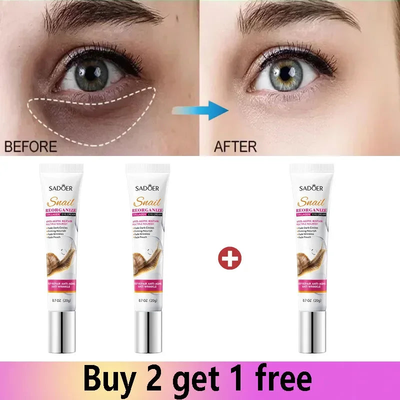 Snail Collagen Eye Cream – Anti-Aging & Moisturizing (20g)