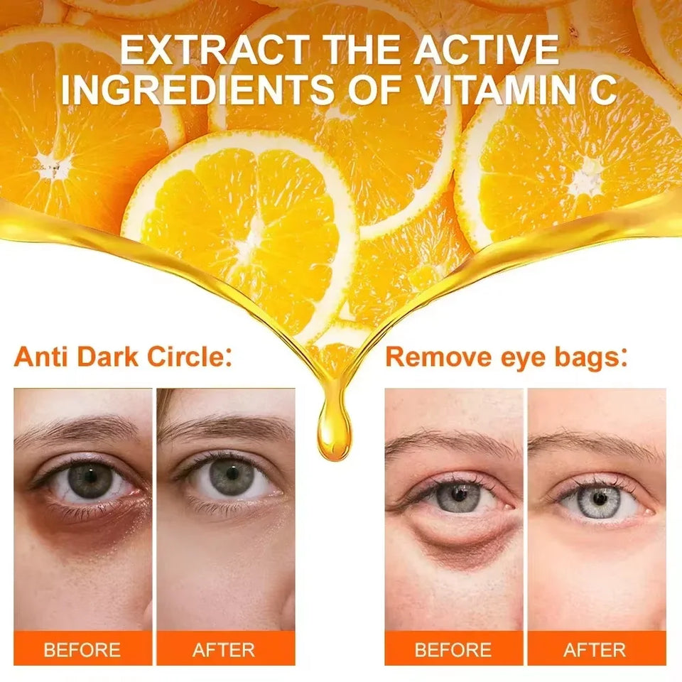Vitamin C Eye Cream for Dark Circles & Puffiness – 1 Unit