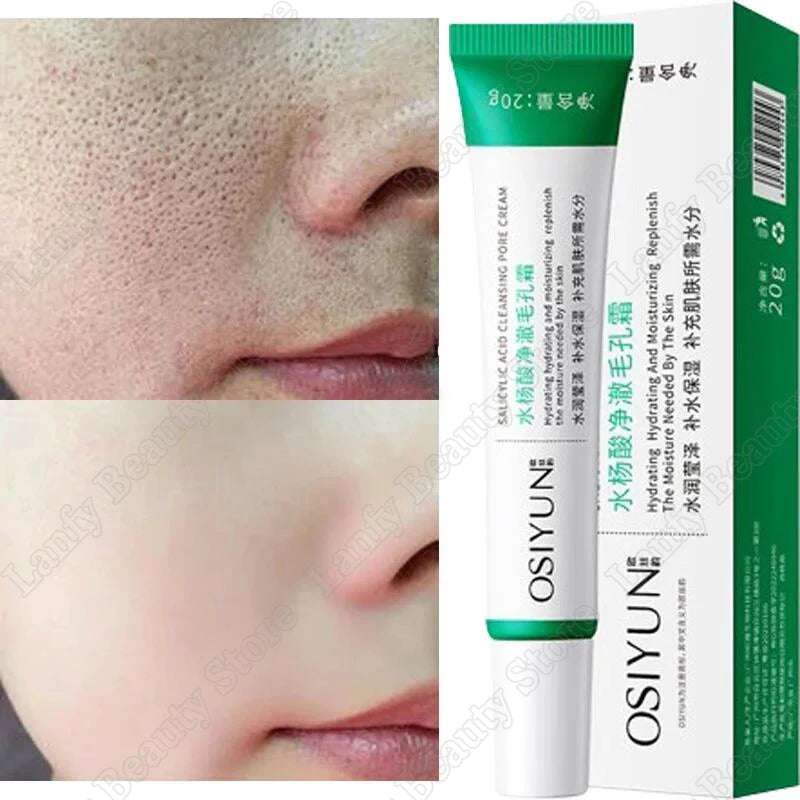 Salicylic Acid Pore Refining Face Cream – 20g