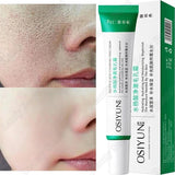 Salicylic Acid Pore Refining Face Cream – 20g