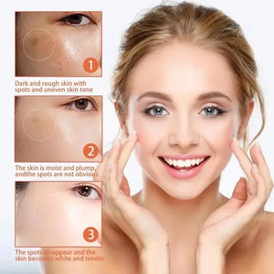 Astragalus Freckle Cream – Dark Spot Remover & Brightening (55g)