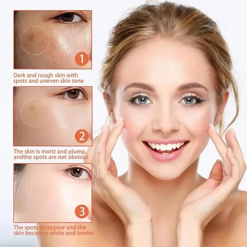 Astragalus Freckle Cream – Dark Spot Remover & Brightening (55g)
