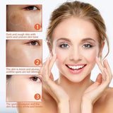Astragalus Freckle Cream – Dark Spot Remover & Brightening (55g)