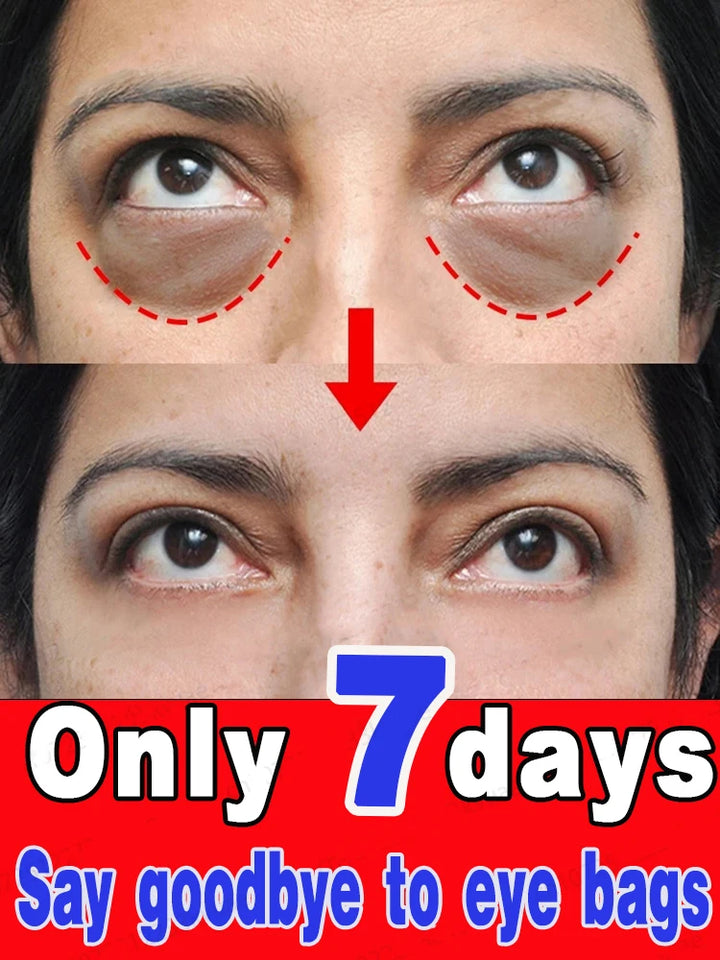 Snail Collagen Eye Cream for Dark Circles & Puffiness