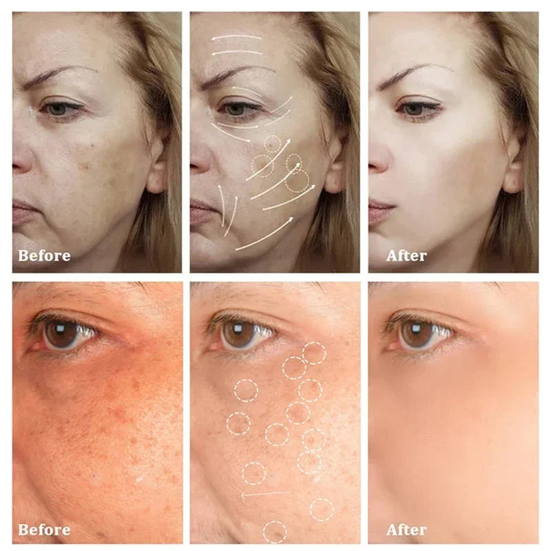 Astragalus Freckle Cream – Dark Spot Remover & Brightening (55g)