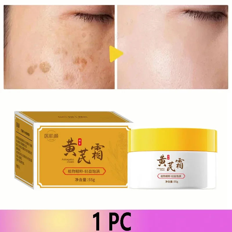 Astragalus Freckle Cream – Dark Spot Remover & Brightening (55g)