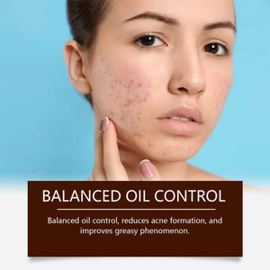 Acne Removal & Brightening Face Cream – Anti-Aging & Whitening