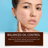 Acne Removal & Brightening Face Cream – Anti-Aging & Whitening