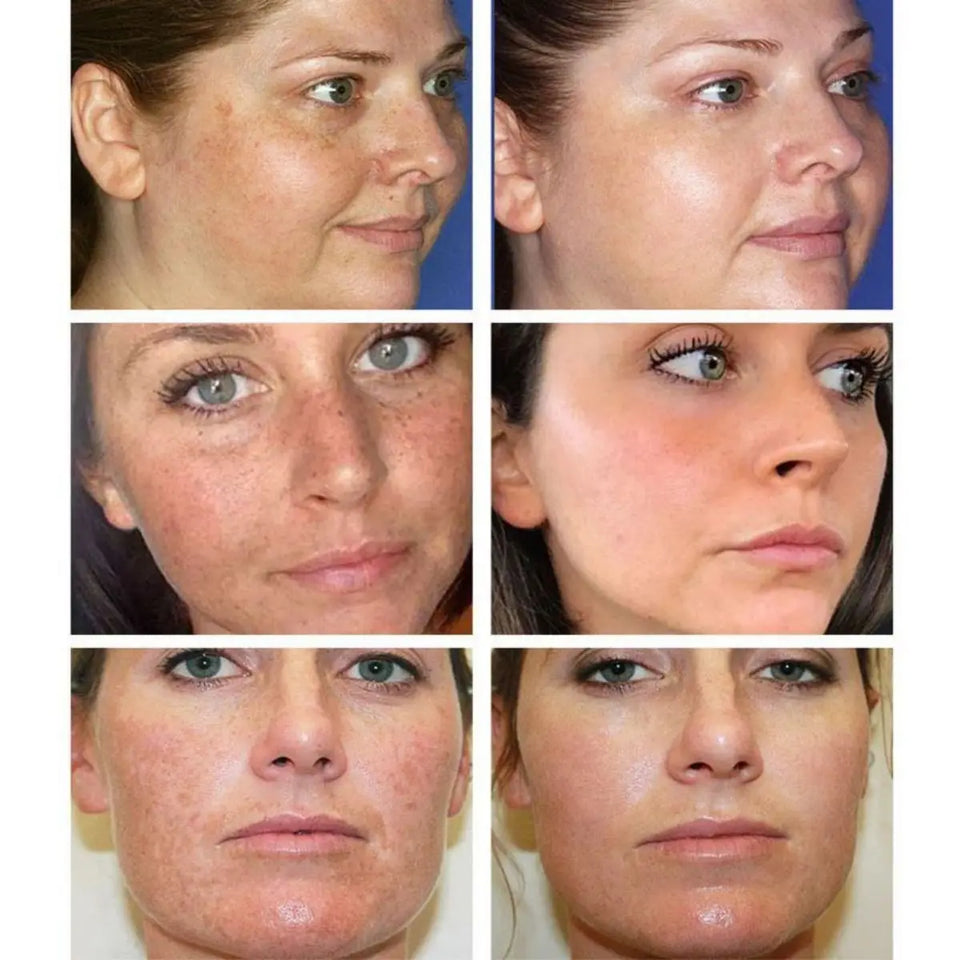 Dark Spot Corrector Face Cream – Anti-Aging, Whitening, Moisturizing
