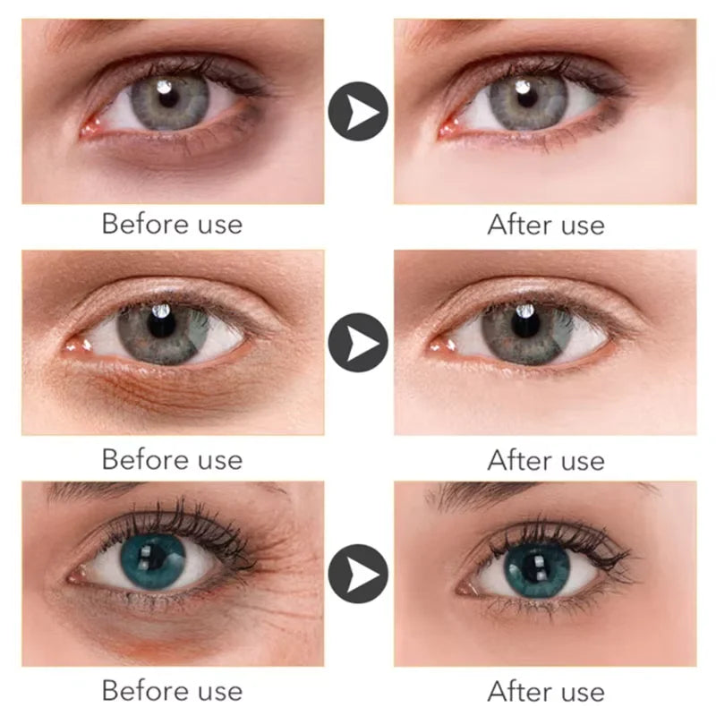 Vitamin C Eye Cream for Dark Circles & Puffiness – 1 Unit