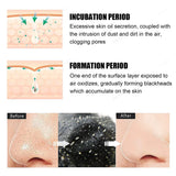 Blackhead Removal Nose Strips – Deep Cleansing & Pore Refining