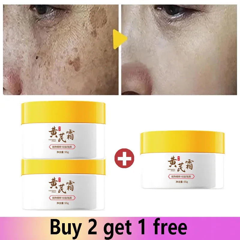 Astragalus Freckle Cream – Dark Spot Remover & Brightening (55g)