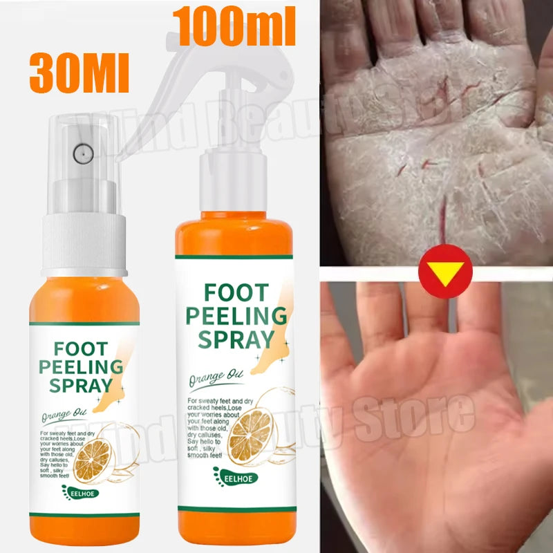 Cracked Heel Repair Foot Cream Spray – Exfoliating & Moisturizing 100ml